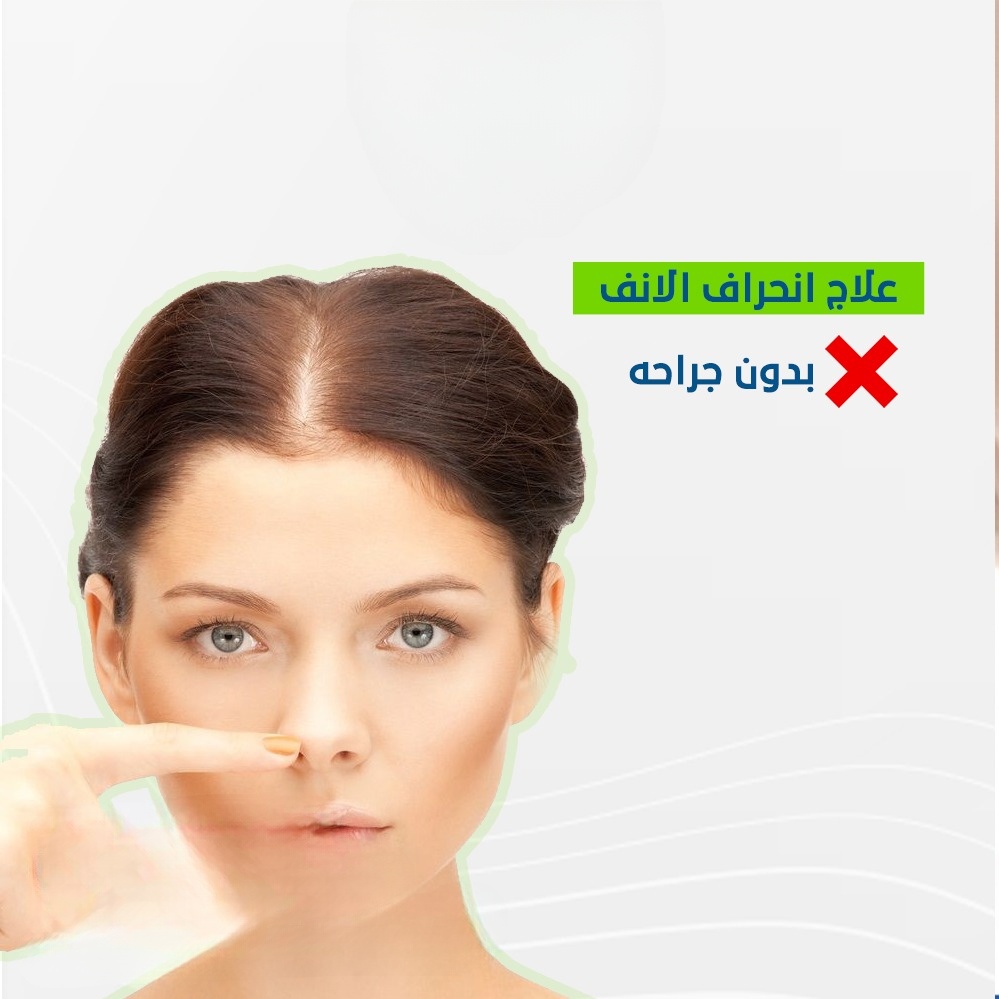 علاج انحراف الانف بدون جراحة