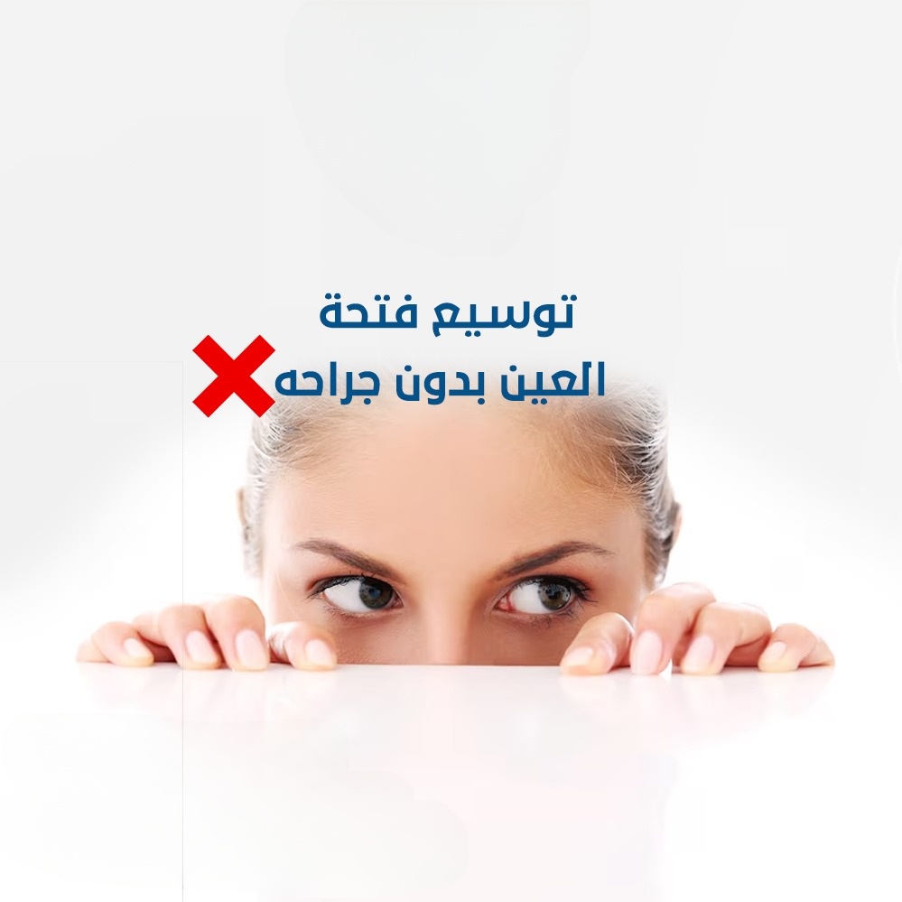 توسيع فتحة العين بدون جراحة