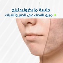 جلسة ميكرونيدلينج + ميزو للقضاء علي الحفر و الندبات